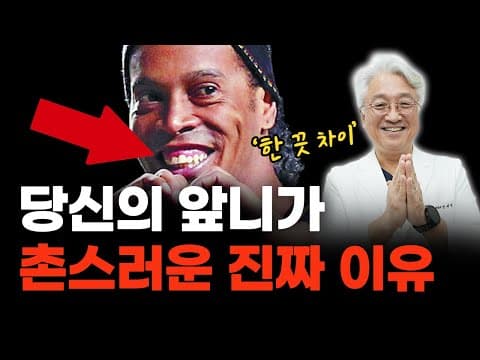 촌티 나는 인상, '앞니' 하나로 세련되게 바꾸는 법. 치료 후 변화..ㄷㄷ [인천치과, 미추홀구치과]