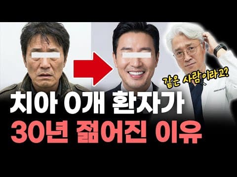 치아 0개 환자가 30년 젊어진 결정적 이유 (feat. 잇몸뼈 부족해도 임플란트 가능할까?) [인천치과, 미추홀구치과]