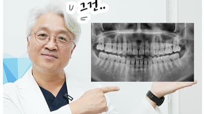 주안동 치과, 왜 자꾸 엑스레이를 찍어요? 비용 얼마에요?